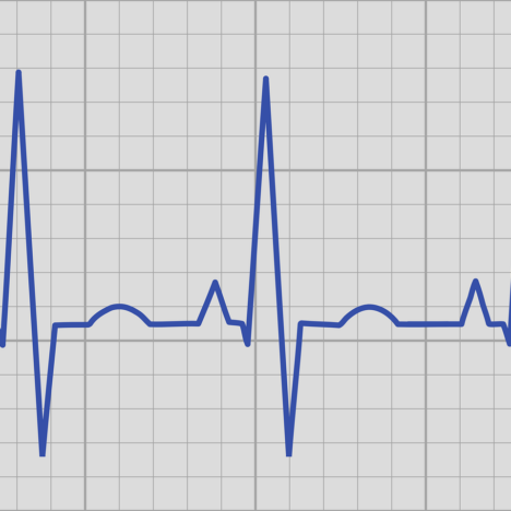 Todos dicen… «whatever it takes»